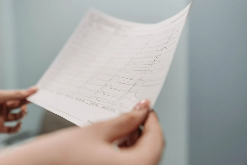Traçado de eletrocardiograma sendo analisado, em fotografia ilustrativa.
