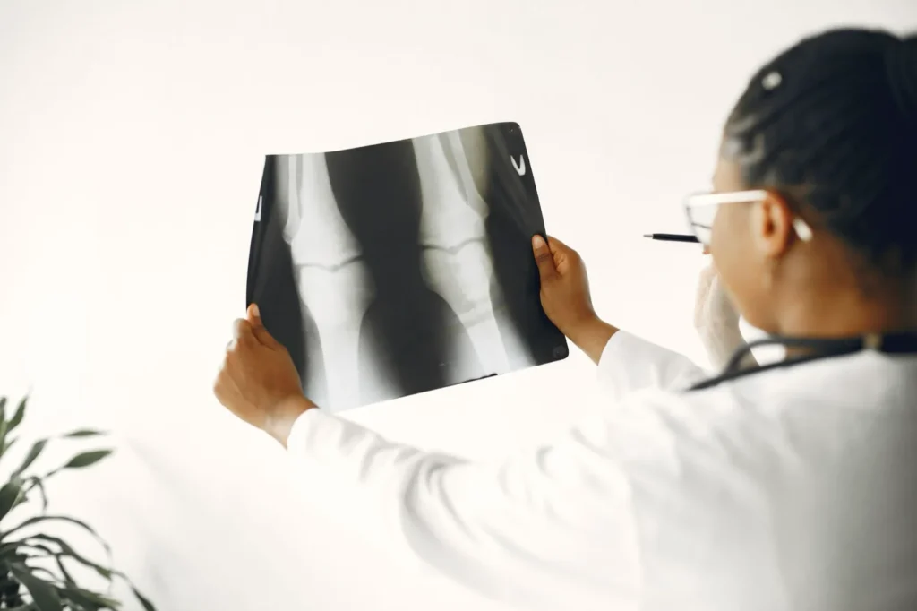 Profissional analisando radiografia do joelho, em fotografia ilustrativa.